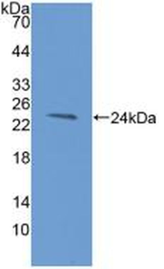 CD366 (TIM3) Antibody in Western Blot (WB)