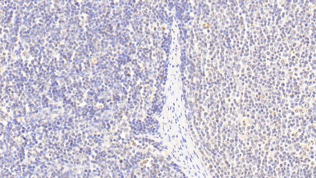 Histone H3 Antibody in Immunohistochemistry (Paraffin) (IHC (P))