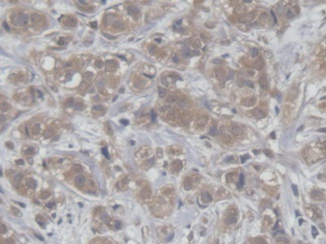 HCFC1 Antibody in Immunohistochemistry (Paraffin) (IHC (P))