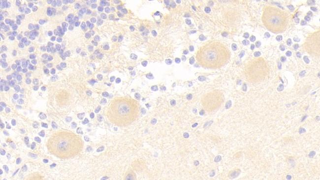 IRS2 Antibody in Immunohistochemistry (Paraffin) (IHC (P))