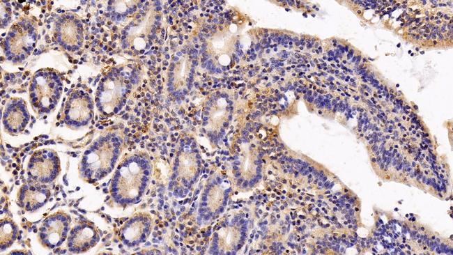 IFNAR2 Antibody in Immunohistochemistry (Paraffin) (IHC (P))