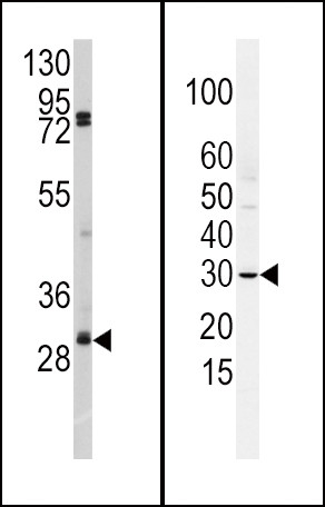 SLUG Antibody in Western Blot (WB)