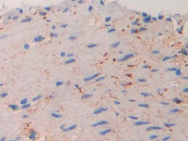 IL11RA Antibody in Immunohistochemistry (Paraffin) (IHC (P))