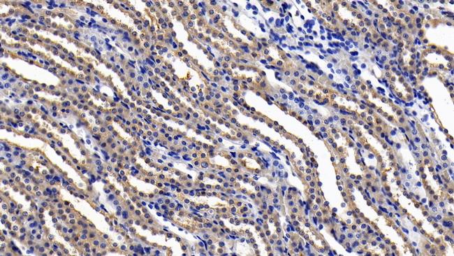 IL11RA Antibody in Immunohistochemistry (Paraffin) (IHC (P))