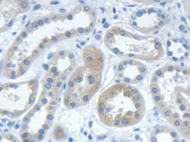 IARS Antibody in Immunohistochemistry (Paraffin) (IHC (P))