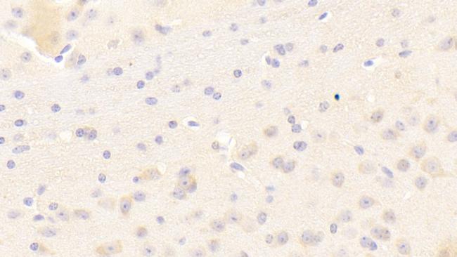 KELL Antibody in Immunohistochemistry (Paraffin) (IHC (P))