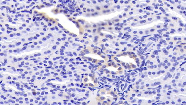 LMAN1 Antibody in Immunohistochemistry (Paraffin) (IHC (P))