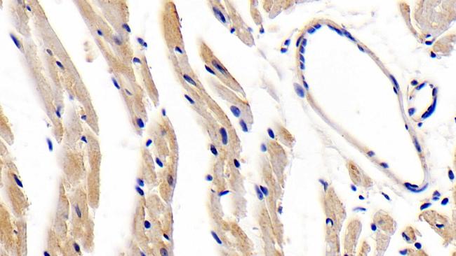 LEPR Antibody in Immunohistochemistry (Paraffin) (IHC (P))