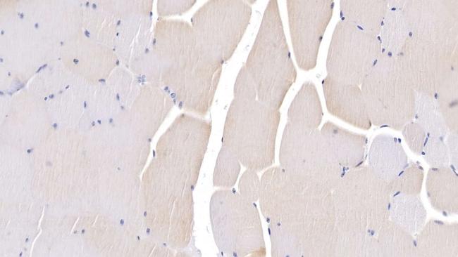 LSR Antibody in Immunohistochemistry (Paraffin) (IHC (P))