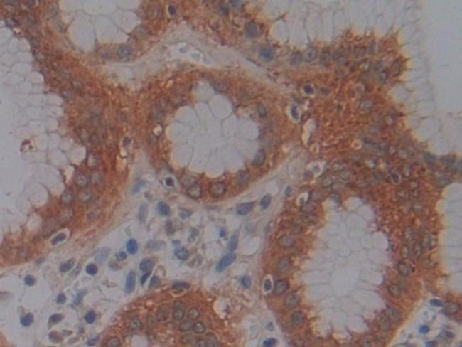 JMJD2A Antibody in Immunohistochemistry (Paraffin) (IHC (P))