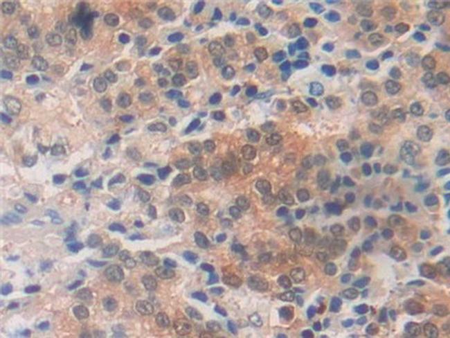 MIF Antibody in Immunohistochemistry (Paraffin) (IHC (P))