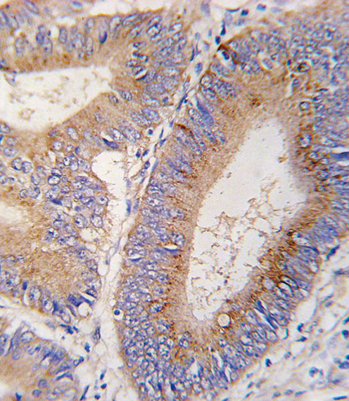 GDF11 Antibody in Immunohistochemistry (Paraffin) (IHC (P))