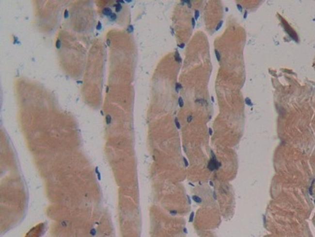 MYH2 Antibody in Immunohistochemistry (Paraffin) (IHC (P))