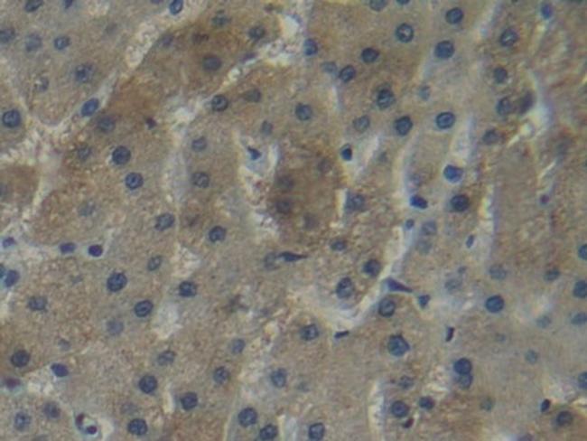 NNMT Antibody in Immunohistochemistry (Paraffin) (IHC (P))