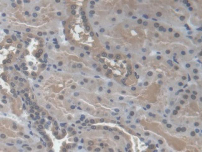 NME3 Antibody in Immunohistochemistry (Paraffin) (IHC (P))