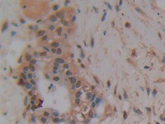 PAK2 Antibody in Immunohistochemistry (Paraffin) (IHC (P))