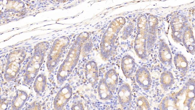 PON2 Antibody in Immunohistochemistry (Paraffin) (IHC (P))