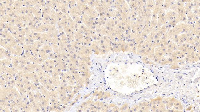 PEX2 Antibody in Immunohistochemistry (Paraffin) (IHC (P))