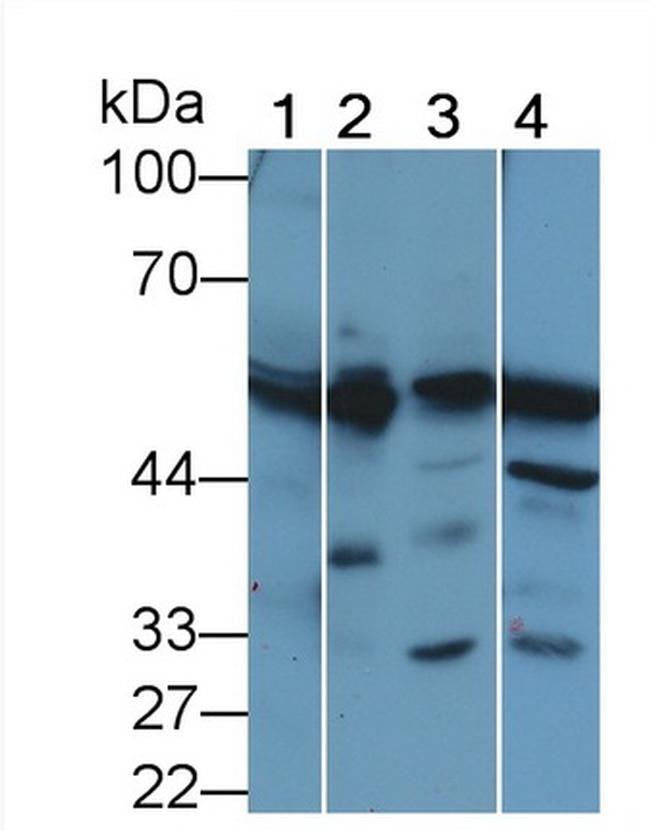 PAH Antibody in Western Blot (WB)