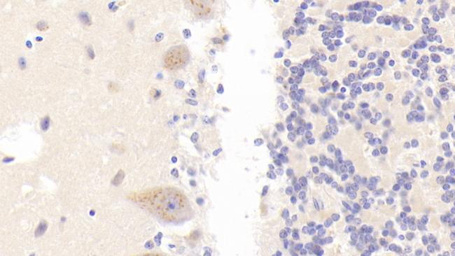 PLB1 Antibody in Immunohistochemistry (Paraffin) (IHC (P))