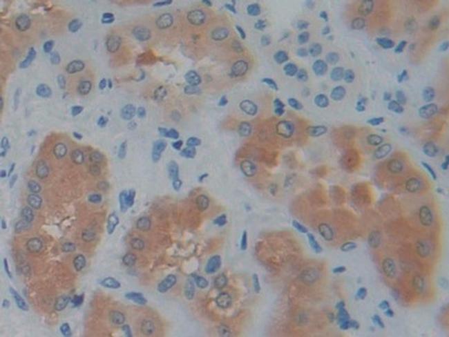 PSAT1 Antibody in Immunohistochemistry (Paraffin) (IHC (P))