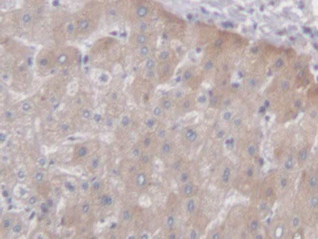 PCYOX1 Antibody in Immunohistochemistry (Paraffin) (IHC (P))