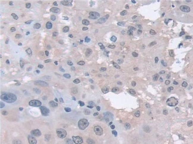 PSMA5 Antibody in Immunohistochemistry (Paraffin) (IHC (P))