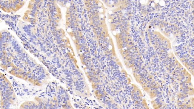 RANK (CD265) Antibody in Immunohistochemistry (Paraffin) (IHC (P))