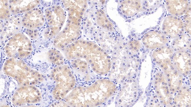 RBP7 Antibody in Immunohistochemistry (Paraffin) (IHC (P))