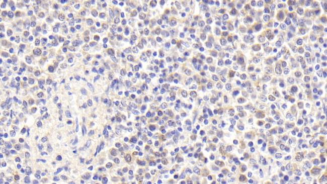 RNASEH2A Antibody in Immunohistochemistry (Paraffin) (IHC (P))