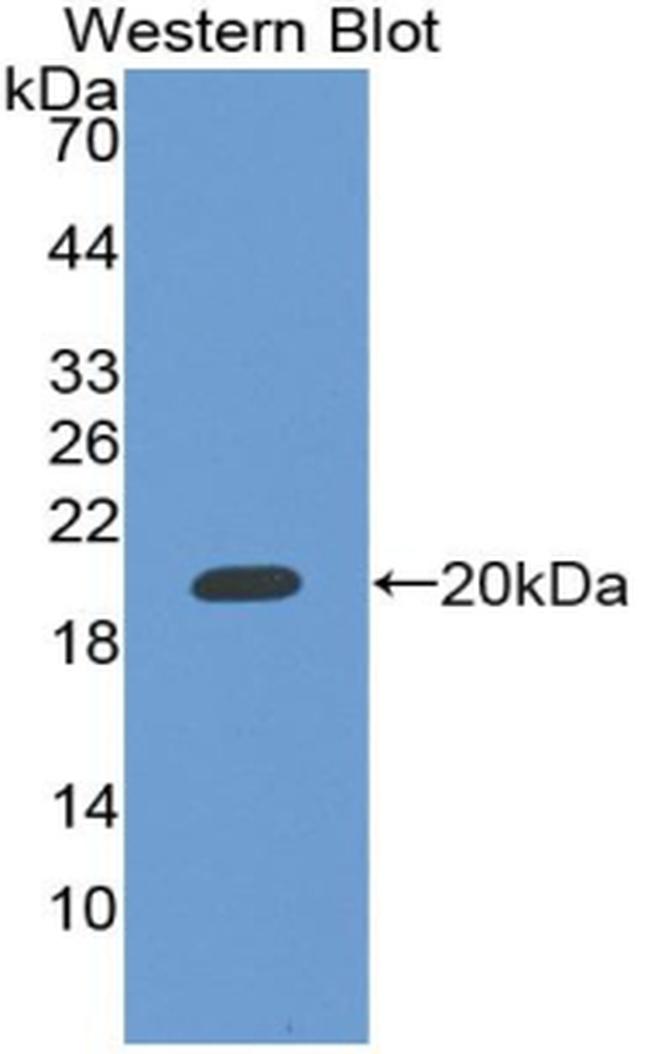 Rbm20 Antibody in Western Blot (WB)