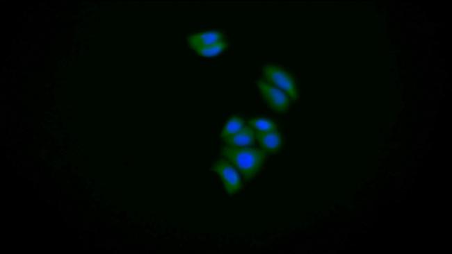 S100A6 Antibody in Immunocytochemistry (ICC/IF)