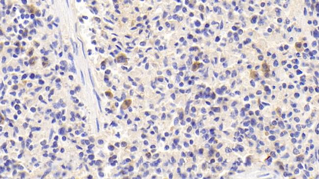 SCRN1 Antibody in Immunohistochemistry (Paraffin) (IHC (P))