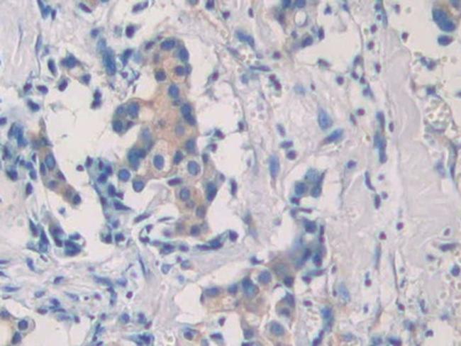 SEPT5 Antibody in Immunohistochemistry (Paraffin) (IHC (P))