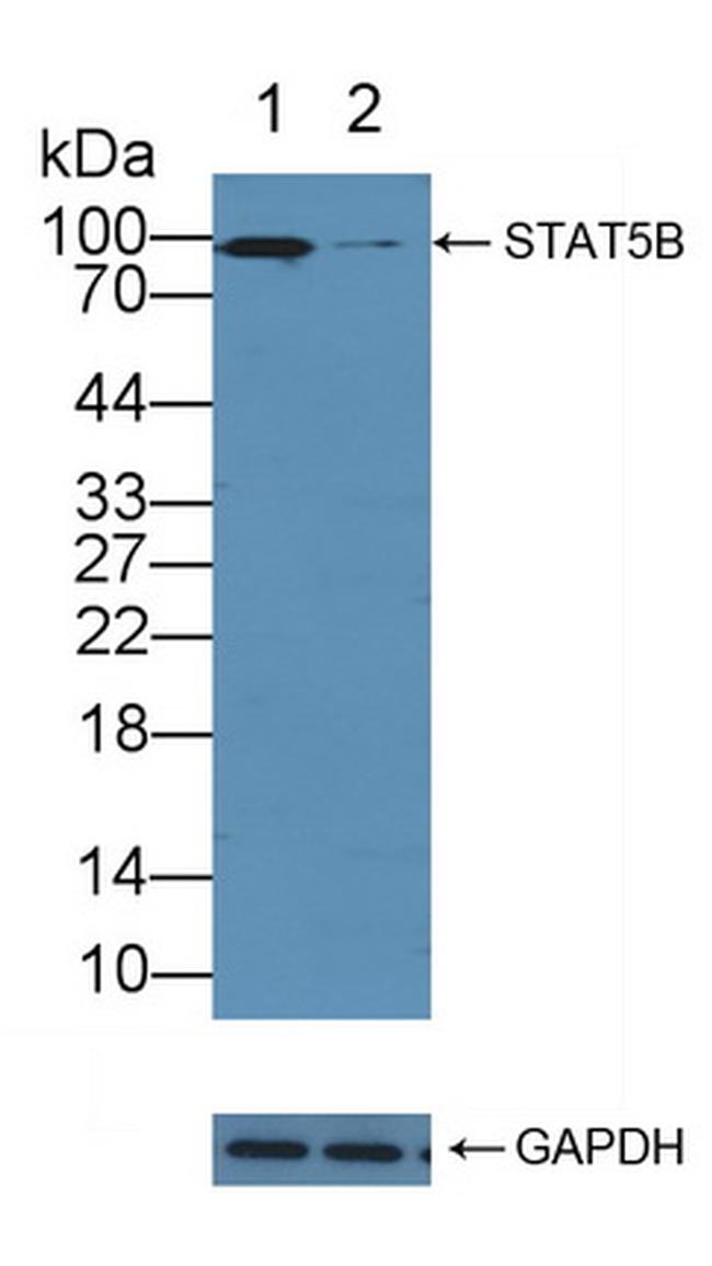 STAT5 beta Antibody in Western Blot (WB)