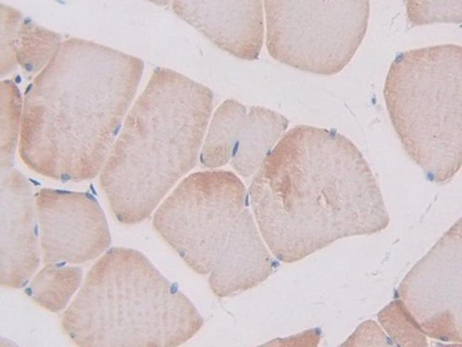 SLIT1 Antibody in Immunohistochemistry (Paraffin) (IHC (P))