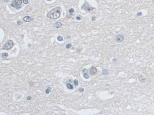 SNRPD1 Antibody in Immunohistochemistry (Paraffin) (IHC (P))