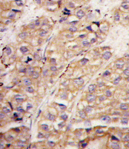 SMURF1 Antibody in Immunohistochemistry (Paraffin) (IHC (P))