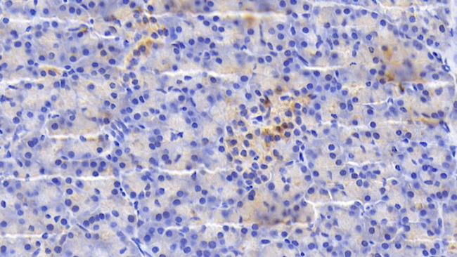 SDF2L1 Antibody in Immunohistochemistry (Paraffin) (IHC (P))