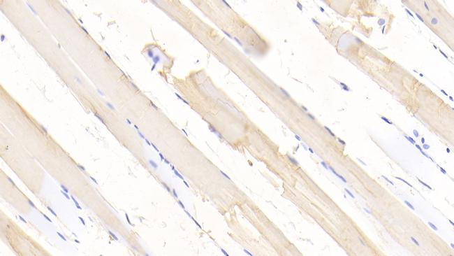 SOD2 Antibody in Immunohistochemistry (Paraffin) (IHC (P))