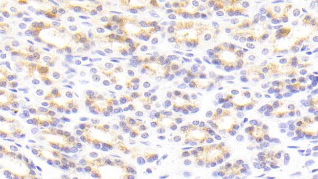 Tenascin C Antibody in Immunohistochemistry (Paraffin) (IHC (P))