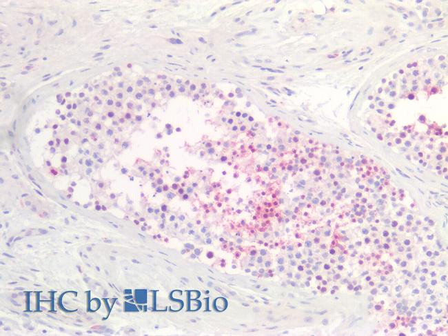 SLC26A8 Antibody in Immunohistochemistry (Paraffin) (IHC (P))