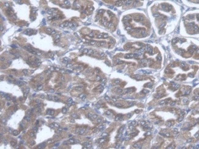 TST Antibody in Immunohistochemistry (Paraffin) (IHC (P))