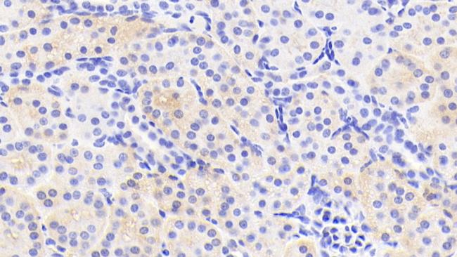 TSTA3 Antibody in Immunohistochemistry (Paraffin) (IHC (P))