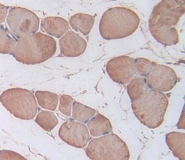 Triadin Antibody in Immunohistochemistry (Paraffin) (IHC (P))