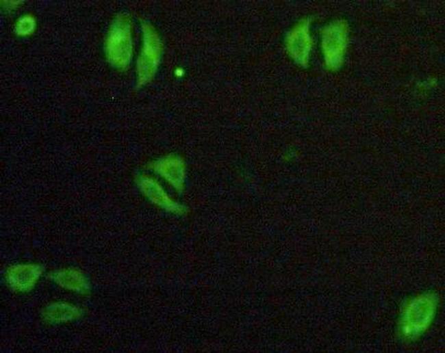 TNFR1 Antibody in Immunocytochemistry (ICC/IF)