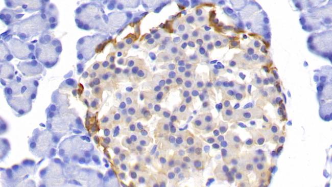 PGP9.5 Antibody in Immunohistochemistry (Paraffin) (IHC (P))