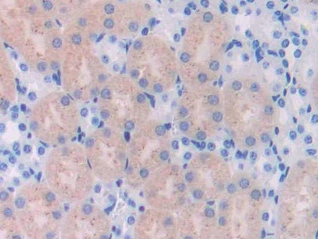 UCHL4 Antibody in Immunohistochemistry (Paraffin) (IHC (P))