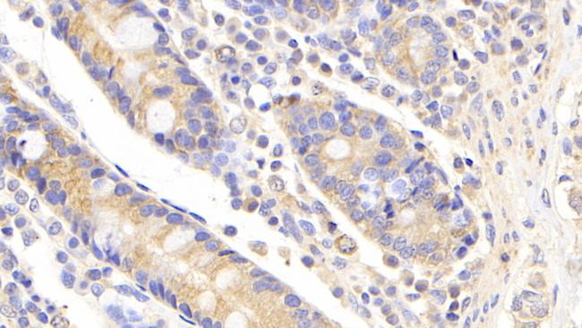 UBE2S Antibody in Immunohistochemistry (Paraffin) (IHC (P))