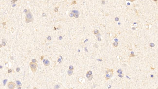 WASP Antibody in Immunohistochemistry (Paraffin) (IHC (P))